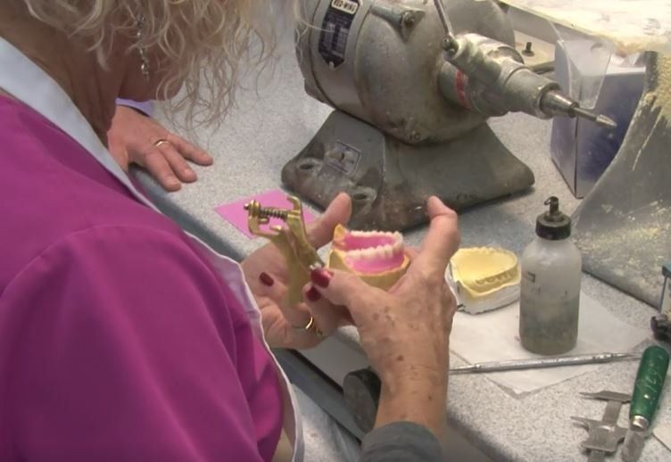 Denture Education Program Module 21 All On Four (4)
